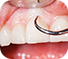 Bad Breath Oral Supplements Tooth
